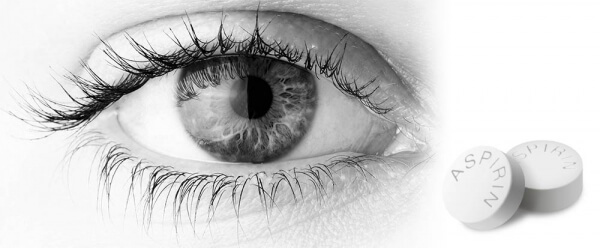 The Association Between Neovascular Age-Related Macular Degeneration and Aspirin Use: Latest Findings but Not the Final Word