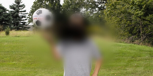 Encouraging Study on the Treatment of Macular Degeneration