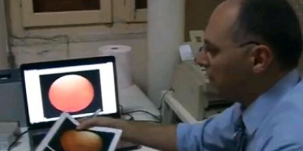 Free fundus examination for macular problems and diabetes complications